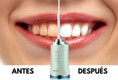 Irrigador Portátil 4 En 1 HidroDent - Sonrisa Perfecta Sin Dolor Ni Interrupciones Y En Tiempo Récord😁