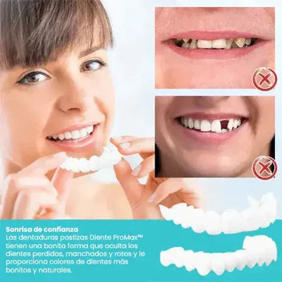 DIENTE PROMAX™ - CARILLAS DENTALES + ENVÍO GRATIS